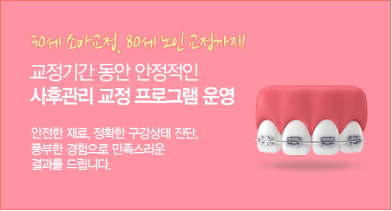 ġ�Ʊ��� ���� ������